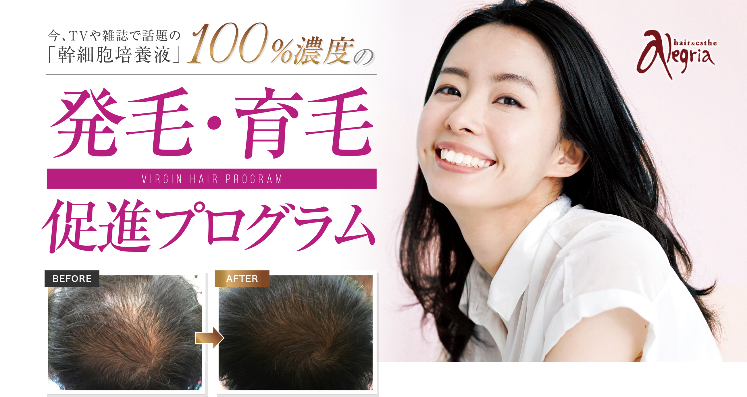 今TVや雑誌で話題の「幹細胞培養液」100%濃度の発毛・育毛促進プログラム